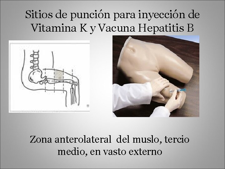 Sitios de punción para inyección de Vitamina K y Vacuna Hepatitis B Zona anterolateral