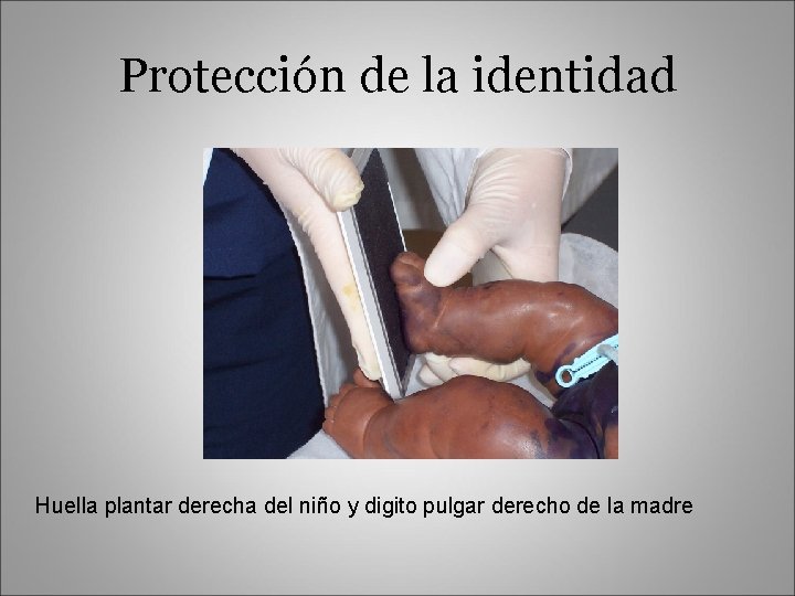 Protección de la identidad Huella plantar derecha del niño y digito pulgar derecho de