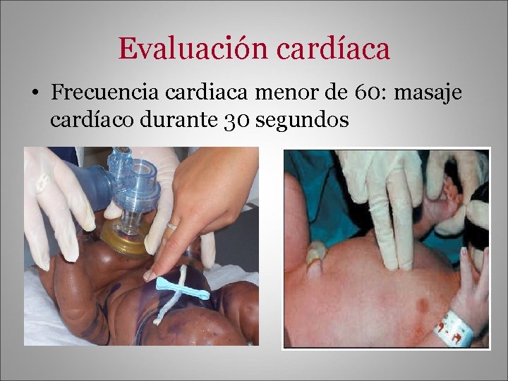 Evaluación cardíaca • Frecuencia cardiaca menor de 60: masaje cardíaco durante 30 segundos 