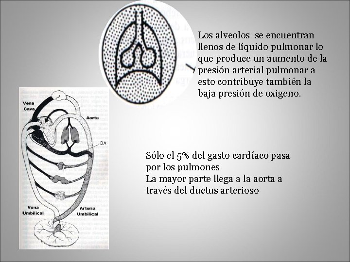 Los alveolos se encuentran llenos de líquido pulmonar lo que produce un aumento de