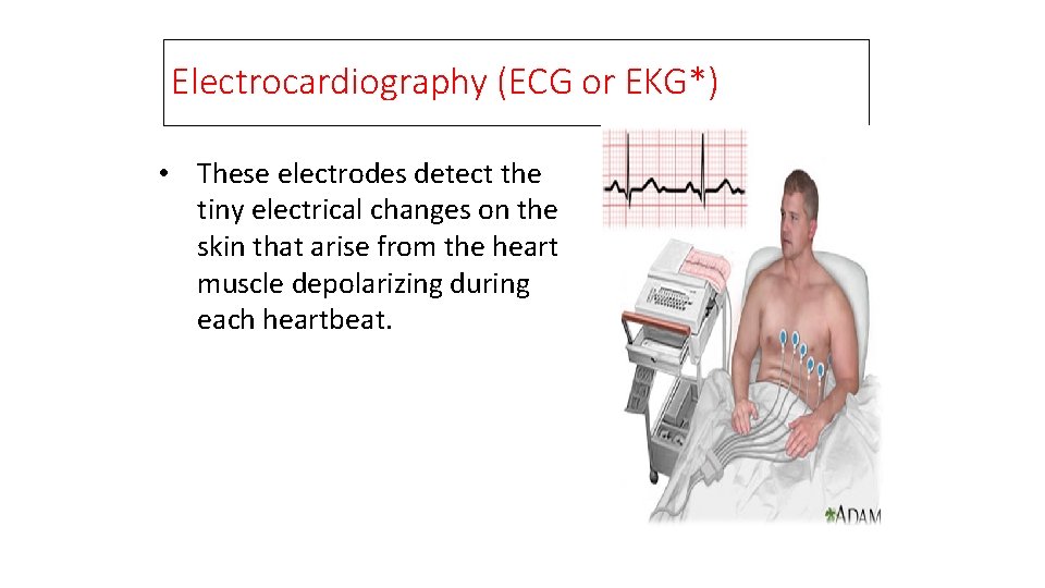 Electrocardiography (ECG or EKG*) • These electrodes detect the tiny electrical changes on the