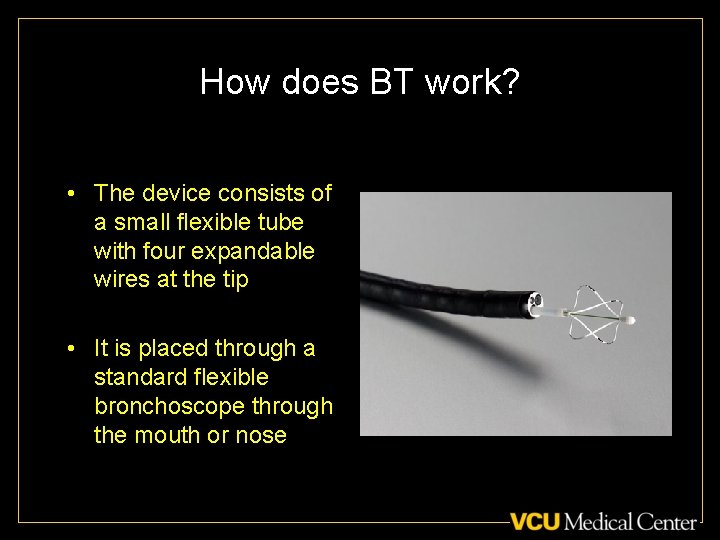 How does BT work? • The device consists of a small flexible tube with