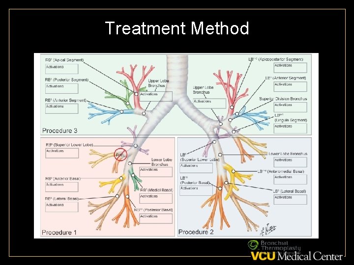 Treatment Method 16 