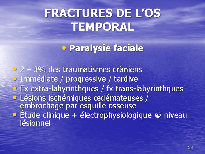 FRACTURES DE L’OS TEMPORAL • Paralysie faciale • 2 – 3% des traumatismes crâniens