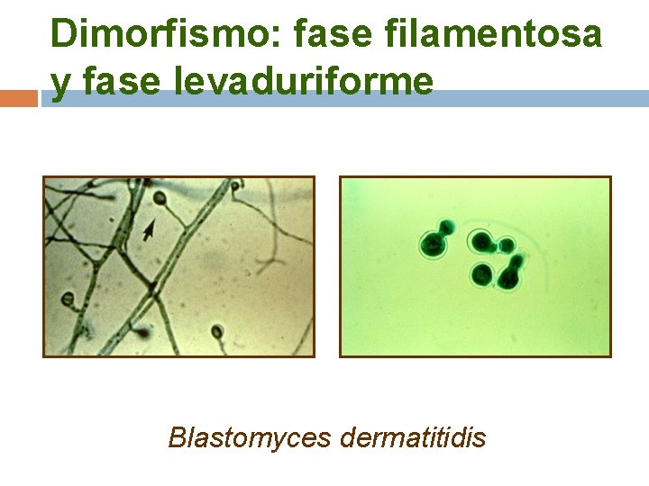 Dimorfismo: fase filamentosa y fase levaduriforme Blastomyces dermatitidis 