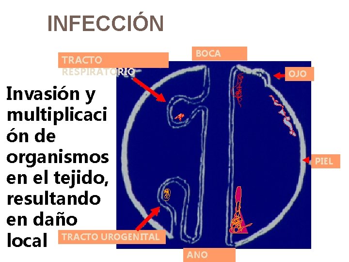 INFECCIÓN TRACTO RESPIRATORIO Invasión y multiplicaci ón de organismos en el tejido, resultando en