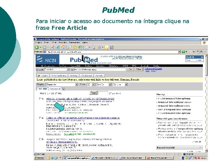 Pub. Med Para iniciar o acesso ao documento na íntegra clique na frase Free