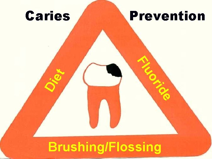 rid Di Prevention uo Fl et Caries e Brushing/Flossing 