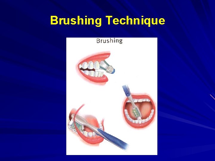 Brushing Technique 
