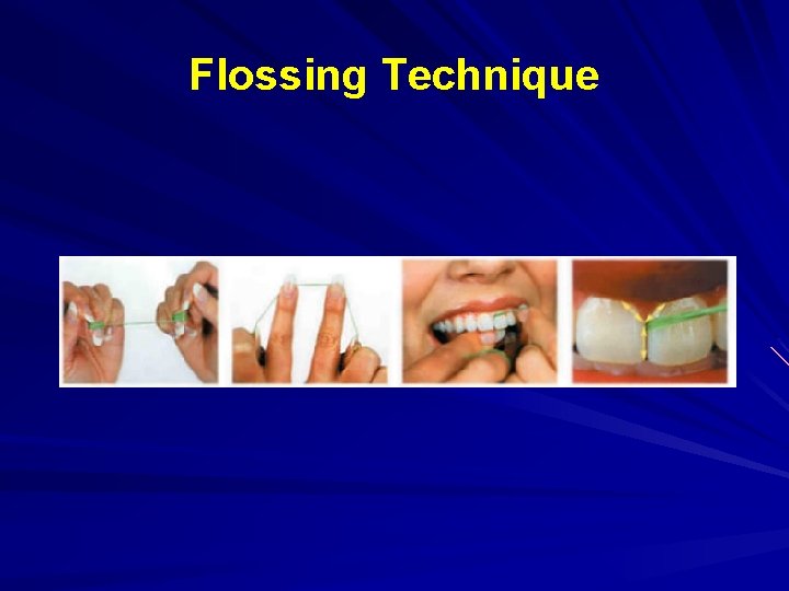Flossing Technique 
