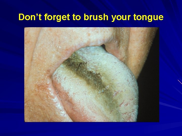Don’t forget to brush your tongue 