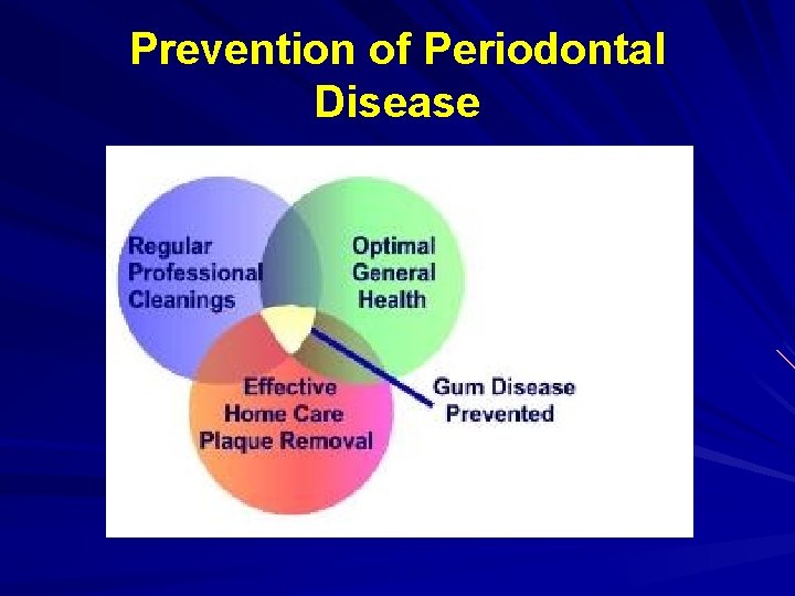 Prevention of Periodontal Disease 