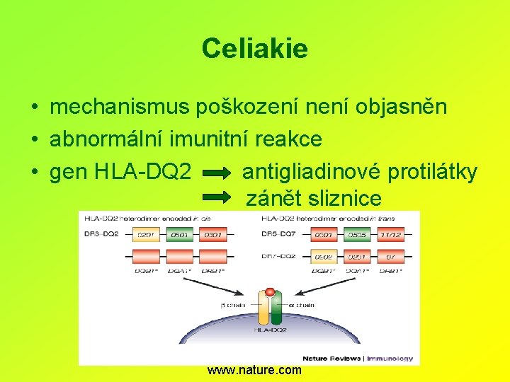 Celiakie • mechanismus poškození není objasněn • abnormální imunitní reakce • gen HLA-DQ 2