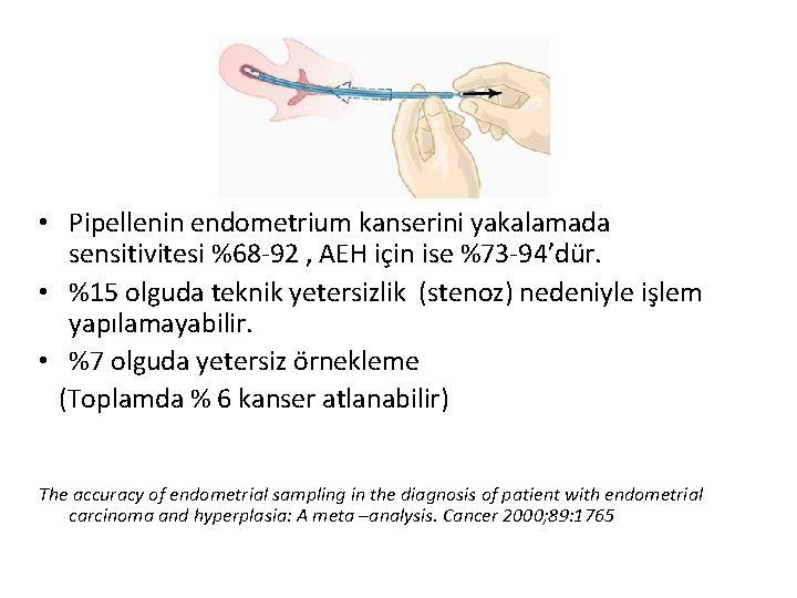  • Pipellenin endometrium kanserini yakalamada sensitivitesi %68 -92 , AEH için ise %73