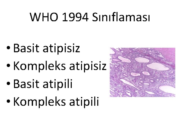WHO 1994 Sınıflaması • Basit atipisiz • Kompleks atipisiz • Basit atipili • Kompleks