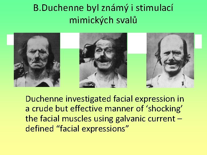 B. Duchenne byl známý i stimulací mimických svalů Duchenne investigated facial expression in a