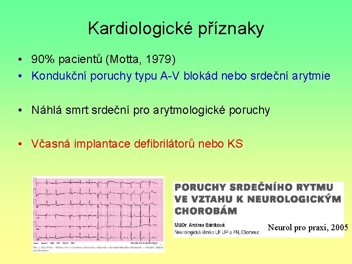 Kardiologické příznaky • 90% pacientů (Motta, 1979) • Kondukční poruchy typu A-V blokád nebo