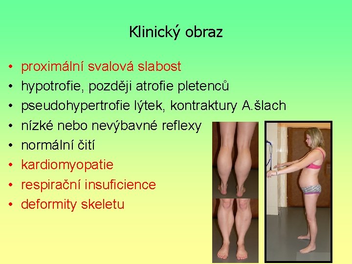 Klinický obraz • • proximální svalová slabost hypotrofie, později atrofie pletenců pseudohypertrofie lýtek, kontraktury