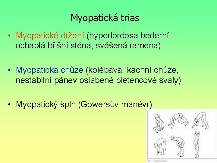 Myopatická trias • Myopatické držení (hyperlordosa bederní, ochablá břišní stěna, svěšená ramena) • Myopatická