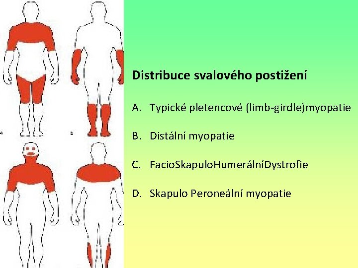 Distribuce svalového postižení A. Typické pletencové (limb-girdle)myopatie B. Distální myopatie C. Facio. Skapulo. HumerálníDystrofie