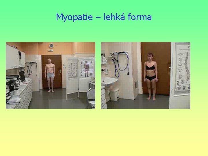 Myopatie – lehká forma 