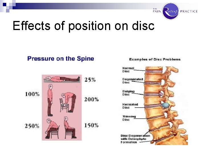 Effects of position on disc 