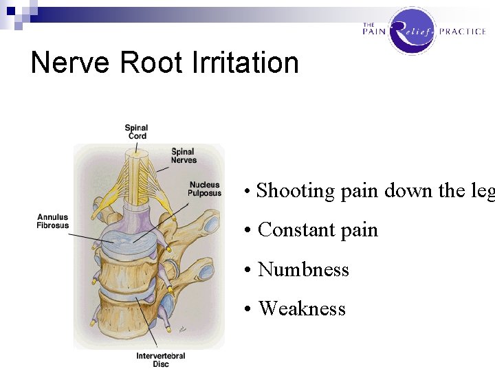 Nerve Root Irritation • Shooting pain down the leg • Constant pain • Numbness