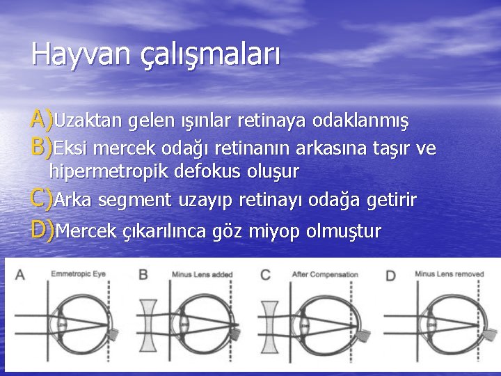 Hayvan çalışmaları A)Uzaktan gelen ışınlar retinaya odaklanmış B)Eksi mercek odağı retinanın arkasına taşır ve