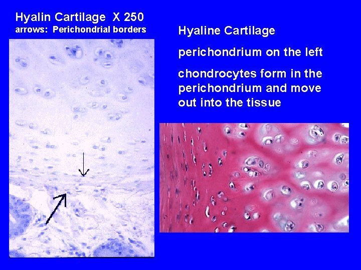 Hyalin Cartilage X 250 arrows: Perichondrial borders Hyaline Cartilage perichondrium on the left chondrocytes