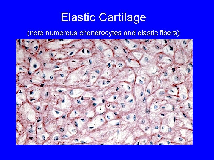 Elastic Cartilage (note numerous chondrocytes and elastic fibers) Elastic Cartilage (note numerous chondrocytes and elastic fibers)