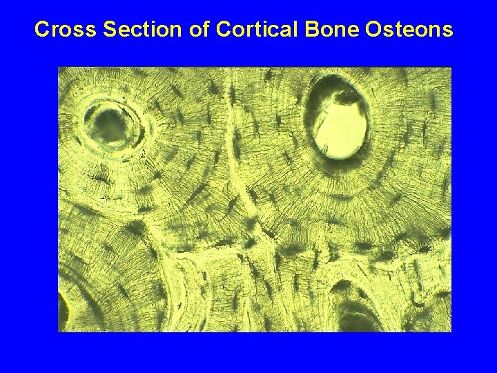 Cross Section of Cortical Bone Osteons 