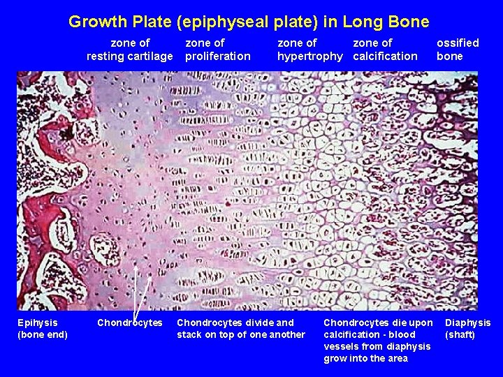Growth Plate (epiphyseal plate) in Long Bone zone of resting cartilage Epihysis (bone end)