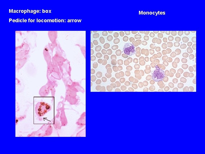 Macrophage: box Pedicle for locomotion: arrow Monocytes 