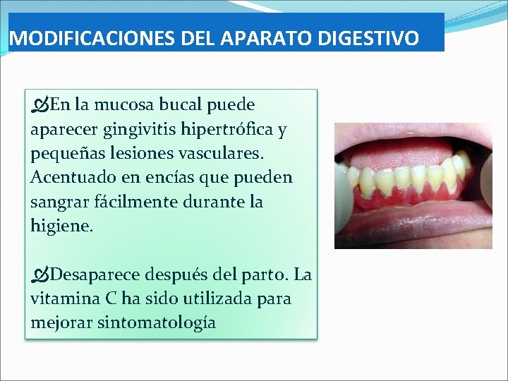 MODIFICACIONES DEL APARATO DIGESTIVO En la mucosa bucal puede aparecer gingivitis hipertrófica y pequeñas