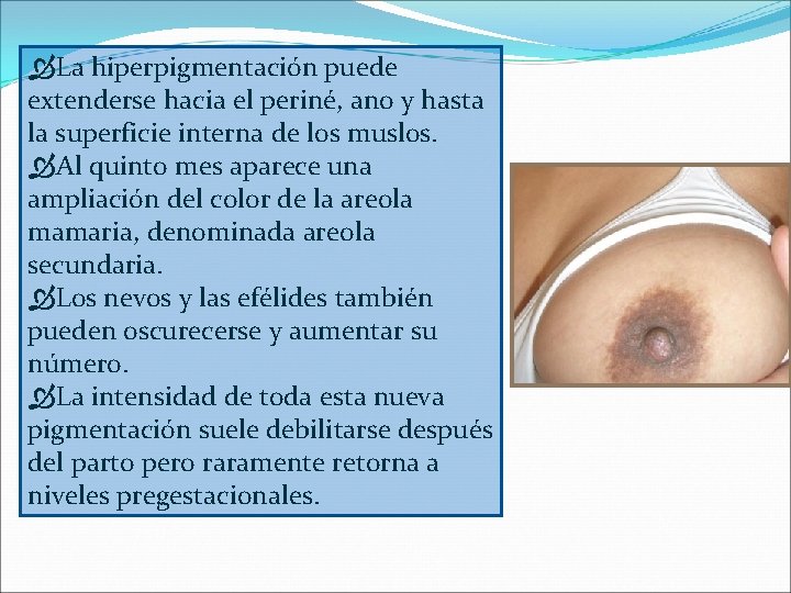  La hiperpigmentación puede extenderse hacia el periné, ano y hasta la superficie interna