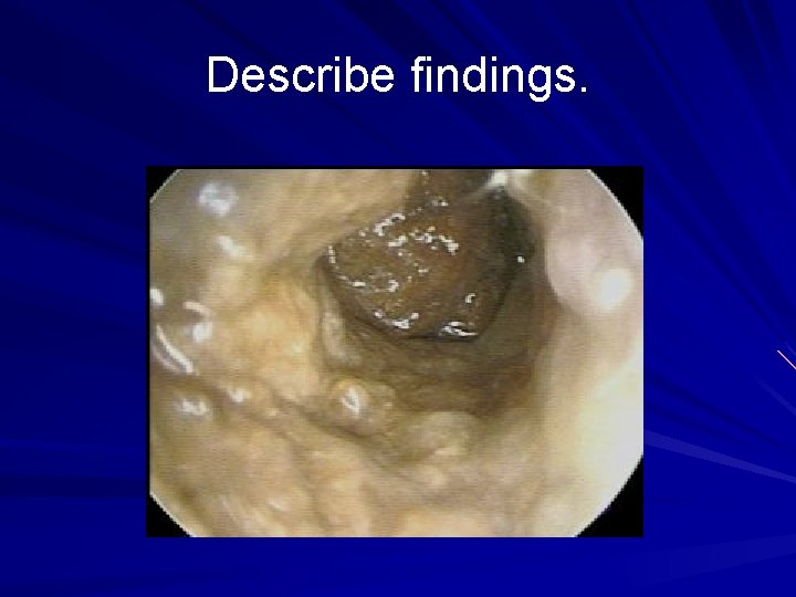 Describe findings. 