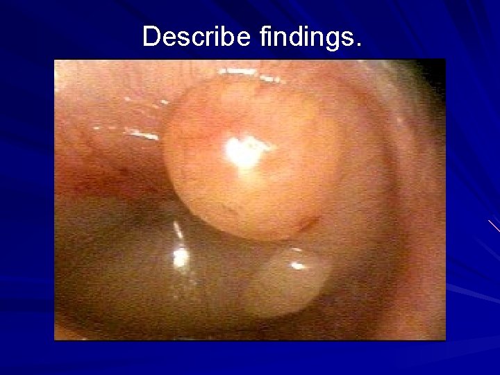 Describe findings. 