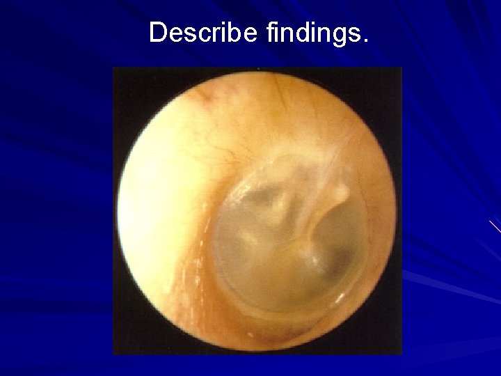 Describe findings. 