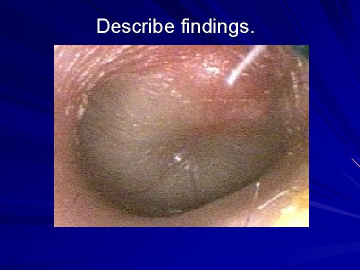 Describe findings. 