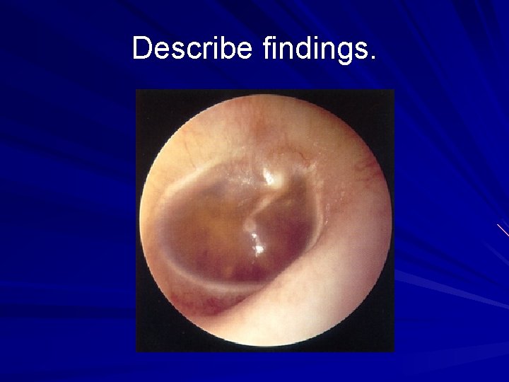 Describe findings. 