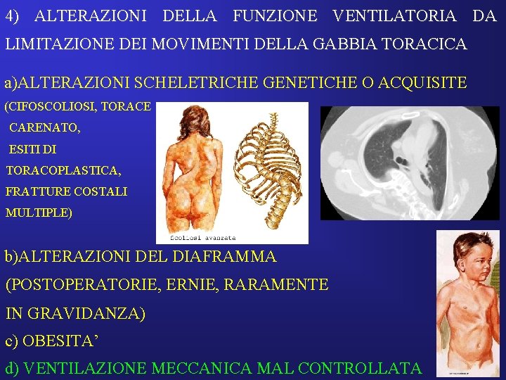 4) ALTERAZIONI DELLA FUNZIONE VENTILATORIA DA LIMITAZIONE DEI MOVIMENTI DELLA GABBIA TORACICA a)ALTERAZIONI SCHELETRICHE