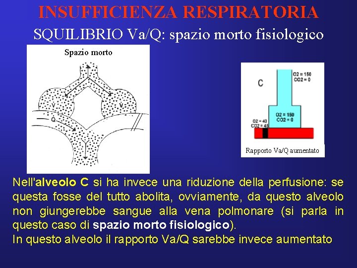 INSUFFICIENZA RESPIRATORIA SQUILIBRIO Va/Q: spazio morto fisiologico Spazio morto Rapporto Va/Q aumentato Nell'alveolo C