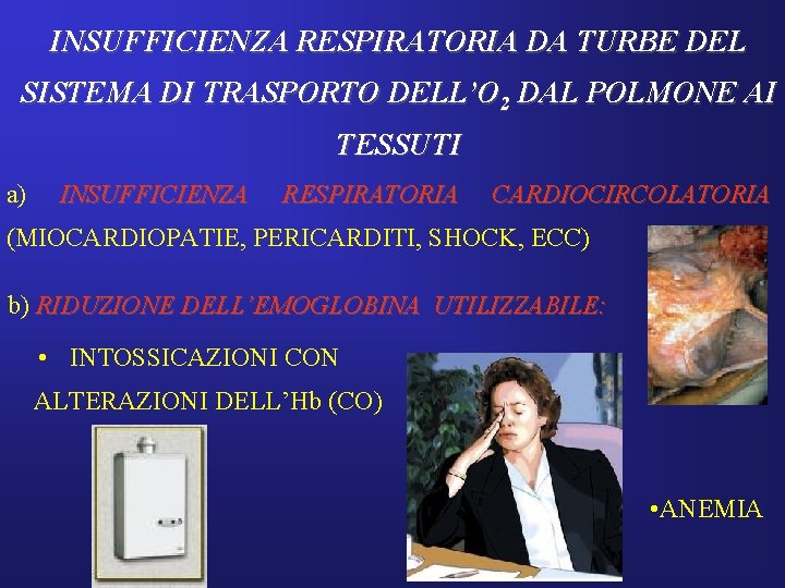 INSUFFICIENZA RESPIRATORIA DA TURBE DEL SISTEMA DI TRASPORTO DELL’O 2 DAL POLMONE AI TESSUTI