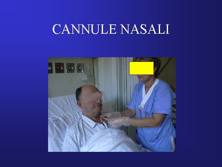 CANNULE NASALI 