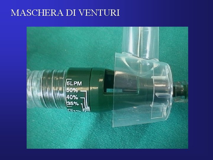 MASCHERA DI VENTURI 