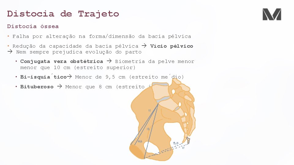 Distocia de Trajeto Distocia óssea • Falha por alteração na forma/dimensão da bacia pélvica