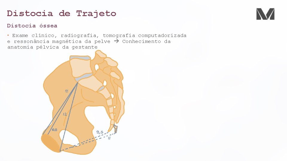 Distocia de Trajeto Distocia óssea • Exame clínico, radiografia, tomografia computadorizada e ressonância magnética