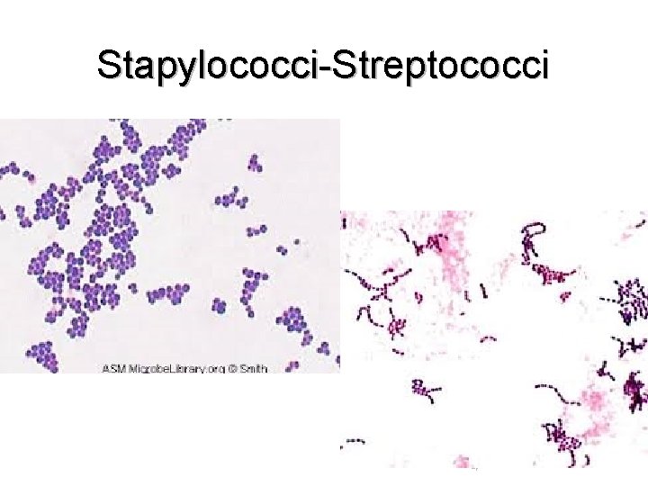 Stapylococci-Streptococci 4 