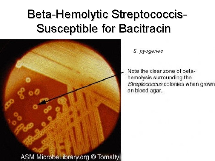 Beta-Hemolytic Streptococcis. Susceptible for Bacitracin S. pyogenes 9 