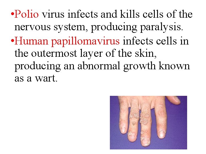  • Polio virus infects and kills cells of the nervous system, producing paralysis.